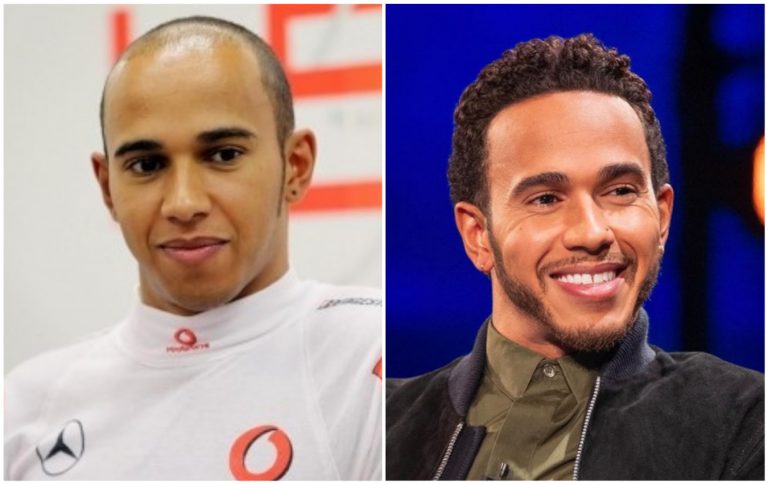 Lewis Hamilton hajbeültetés eredménye