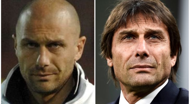 Antonio Conte hajbeültetés eredménye