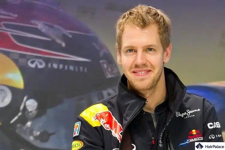 vettel haja már fiatalon elkezdett hullani