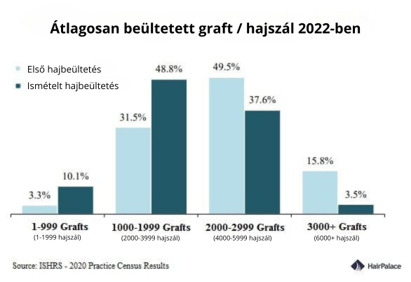 mennyi haj kell egy hajbeültetéshez?