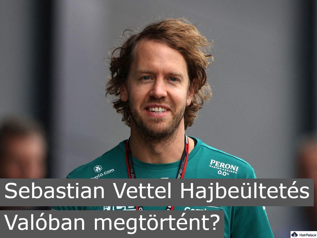 sebastian vettel hajbeültetés valóban megtörtént