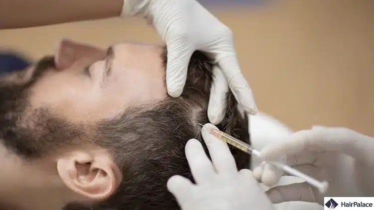 prp kezelés a DHT hajhullás ellen